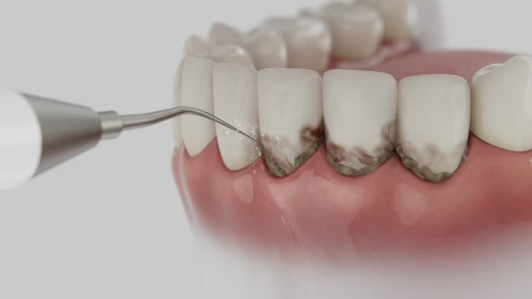 Trusted Teeth Cleaning And Checkup service in Cavalier, ND - Dentist Open Now